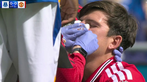  Maguire đổ máu sau pha va chạm kinh hoàng đầu trận Everton vs MU